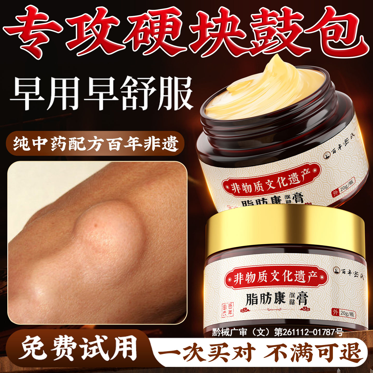 脂肪消瘤肿膏去瘤硬块除神器全身特效皮肤下单发性多发性克星专用