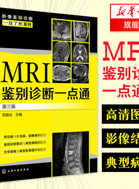 MRI鉴别诊断一点通 第三版 医学影像学 临床科室医生影像科医师参考书籍 临床医学医生参考 凤凰新华书店旗舰店正版