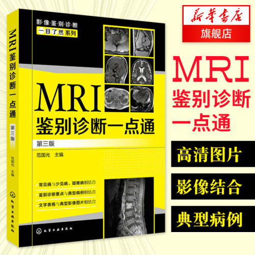 MRI鉴别诊断一点通 第三版 医学影像学 临床科室医生影像科医师参考书籍 临床医学医生参考 凤凰新华书店旗舰店正版