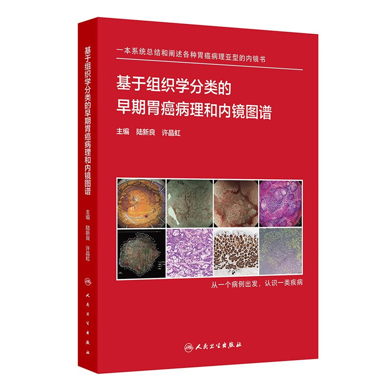基于组织学分类的早期胃癌病理和内镜图谱 陆新良 人民卫生出版社 基础医学 新华正版书籍