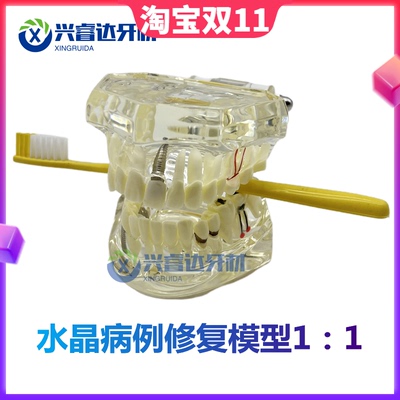 牙齿模型幼儿园早教刷牙模具标准两倍假牙科儿童宝宝口腔教学道具