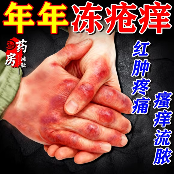 【医用级】手足冻疮膏