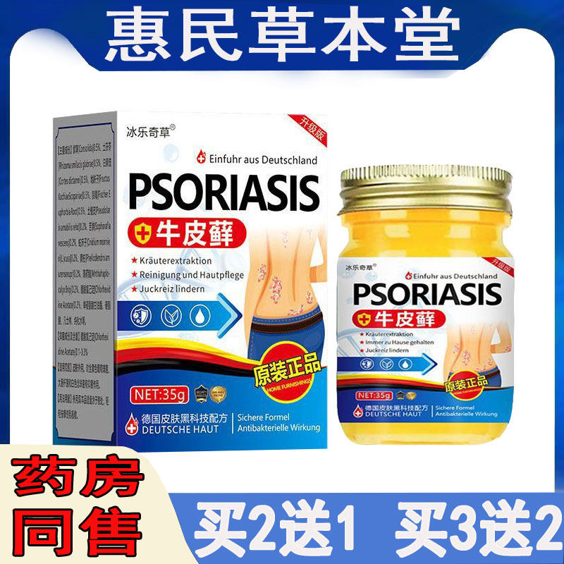 拍2发3冰乐奇草牛皮藓乳膏过敏性皮焱湿珍汗疱体股藓红斑丘疹软膏