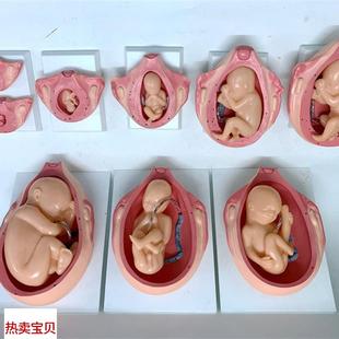 妊娠胚胎发育 胚胎教学模型 胎儿形成发育过程模型 H计划生育胎儿