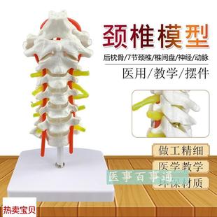 颈椎模型 厂家直销 颈椎带颈动脉 后枕骨E 椎间盘与神经模型