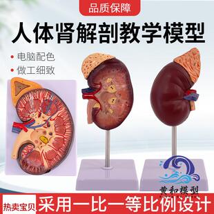 肾解剖附肾上腺放大模型病变肾脏 人体肾脏a模型 人体内脏器官解