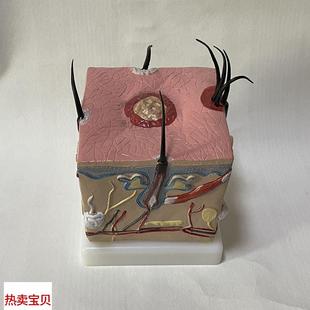 脱发生发T植发人体皮肤层 康泰模型头皮结构头发脱落护理医药促销