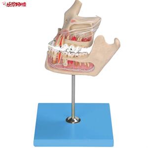 牙体病变模型hB1001