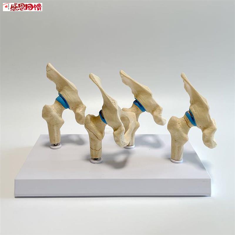 人髋关节模型股骨头软V骨损伤病理骨科医药促销手术示教股骨颈骨