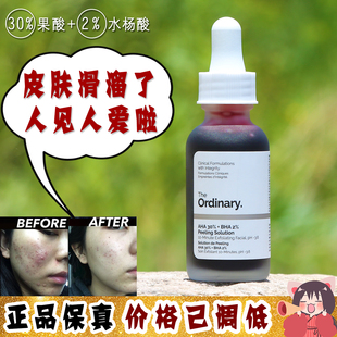 大怪飞现货强笑刷酸The Ordinary30%果酸+2%水杨酸去角质焕肤面膜