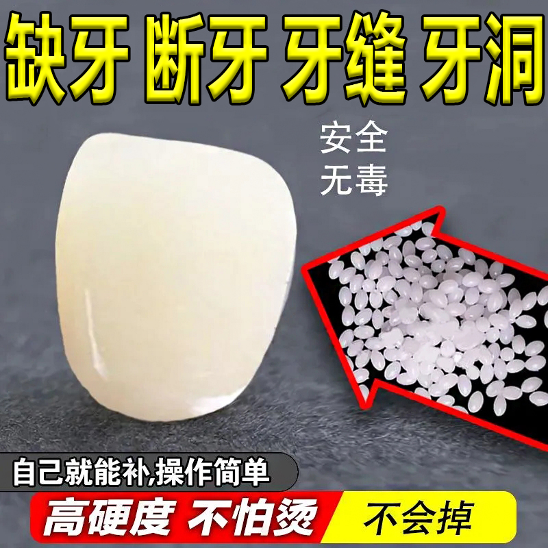当天发货补牙齿洞膏进口材料树脂