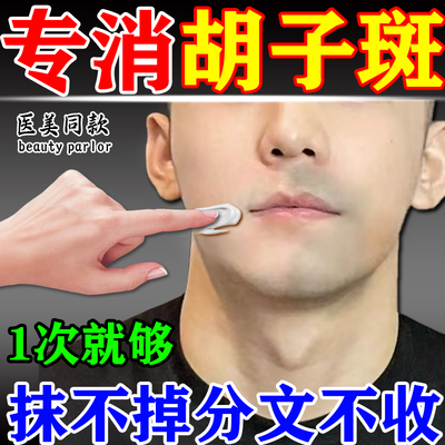 胡子斑去除改善唇周黑色素沉淀黑印淡化嘴角黑暗沉黑斑胡青色素膏