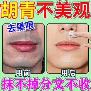 胡青去除男士淡化胡子根黑印胡茬络腮胡唇毛胡须刮完遮瑕膏脱毛女