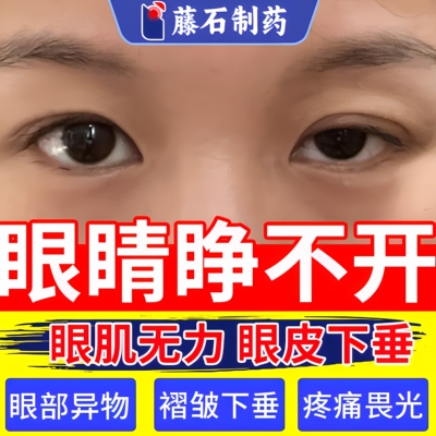 眼睛视物模糊肌无力上眼睑贴下垂