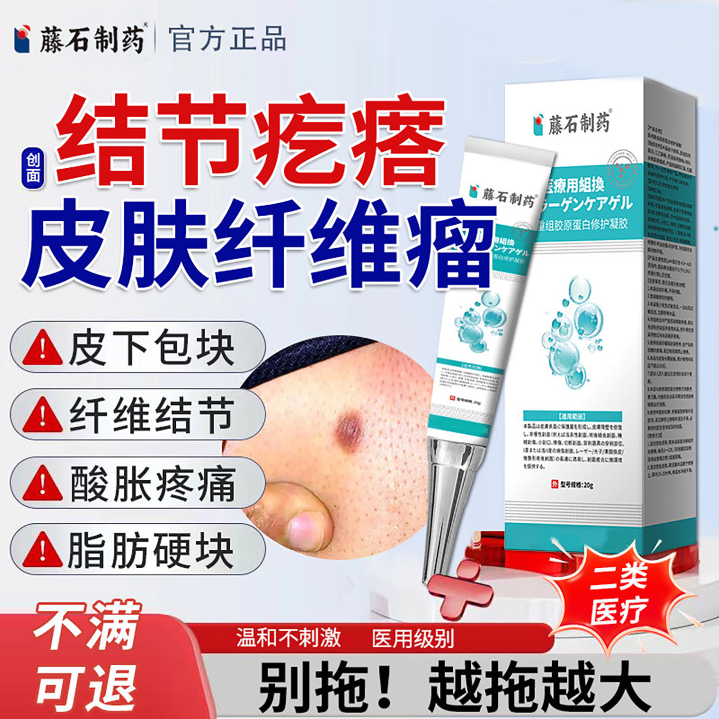 藤石制药非皮肤纤维瘤去除软膏皮下肿硬块疙瘩结节消瘤搭膏药贴YU