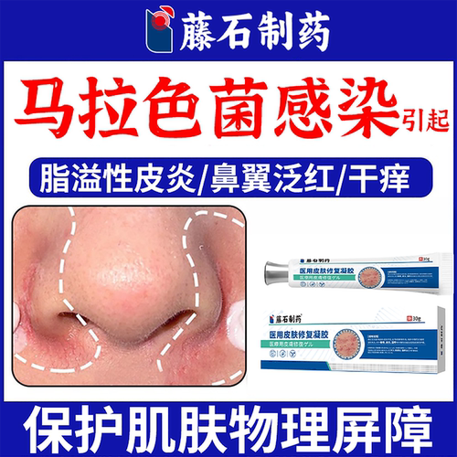 藤石制药脂溢性皮炎医用凝胶