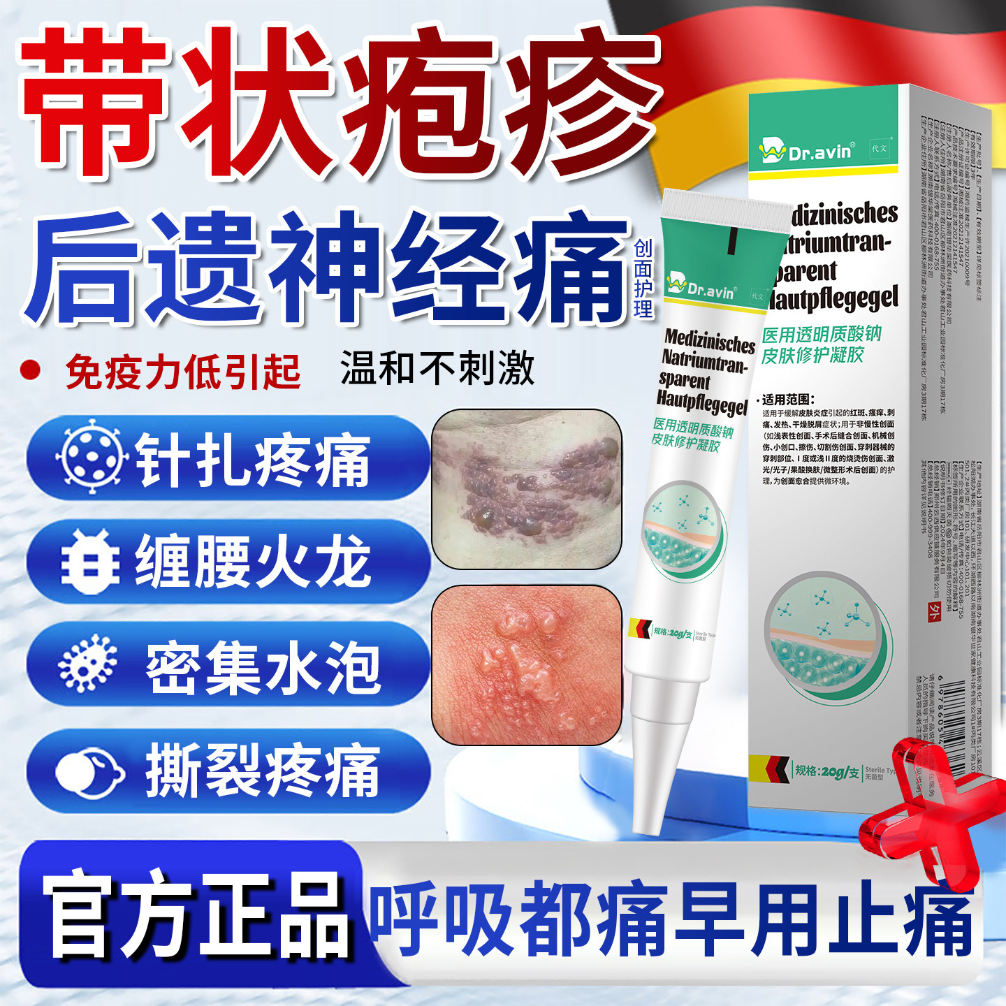 Dravin代文带状疱疹后遗症神经痛外用修复酶蛇盘疮止特膏药贴效YU,医疗器械,保健理疗,淘宝优惠券,粉丝福利购,淘宝优惠卷