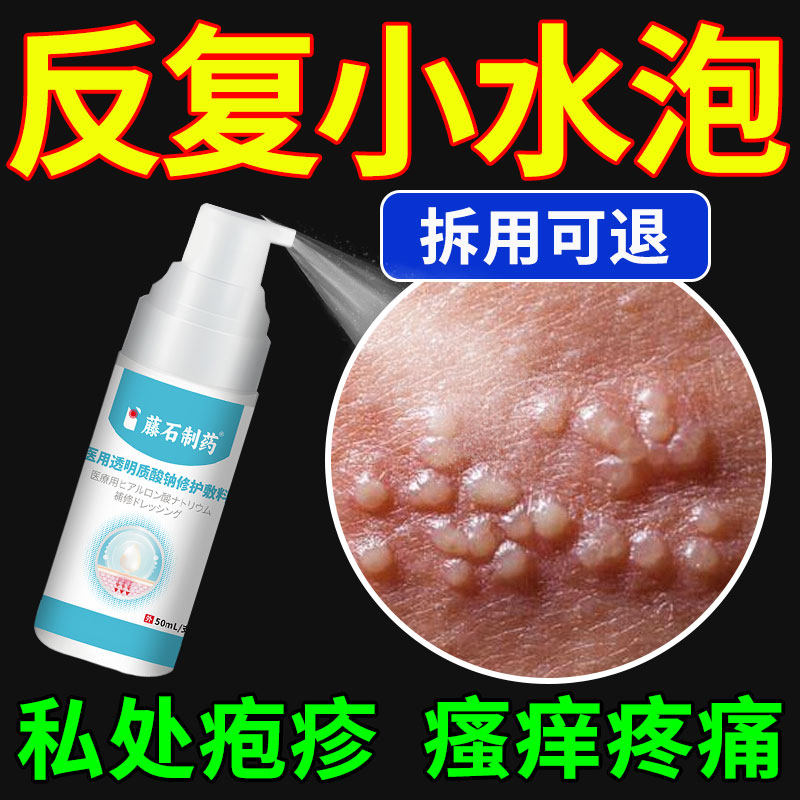 生殖器疱疹疱疹清克喷雾真菌感染男女防复发中可搭膏药贴单纯QQ