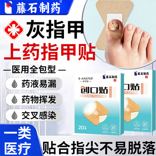 灰指甲上药套封包创可贴保护套手指脚趾套涂药药膏防蹭医用无菌ON