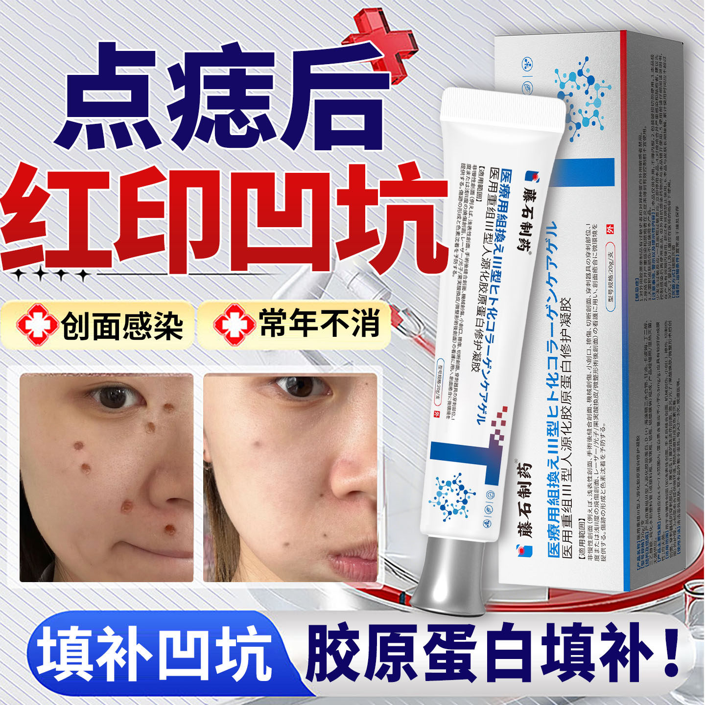 点痣后疤痕红印去黑印色素沉淀修复膏除祛疤防水贴搭专用修复液ZY