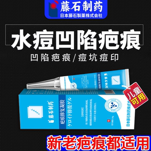 水痘疤痕痘坑痘印凹陷儿童成人可搭填充淡化黑色素沉淀医用凝胶LJ