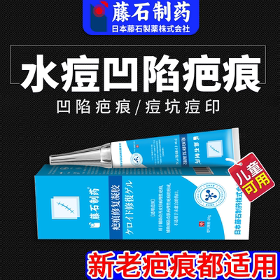 水痘疤痕痘坑痘印医用修复凝胶