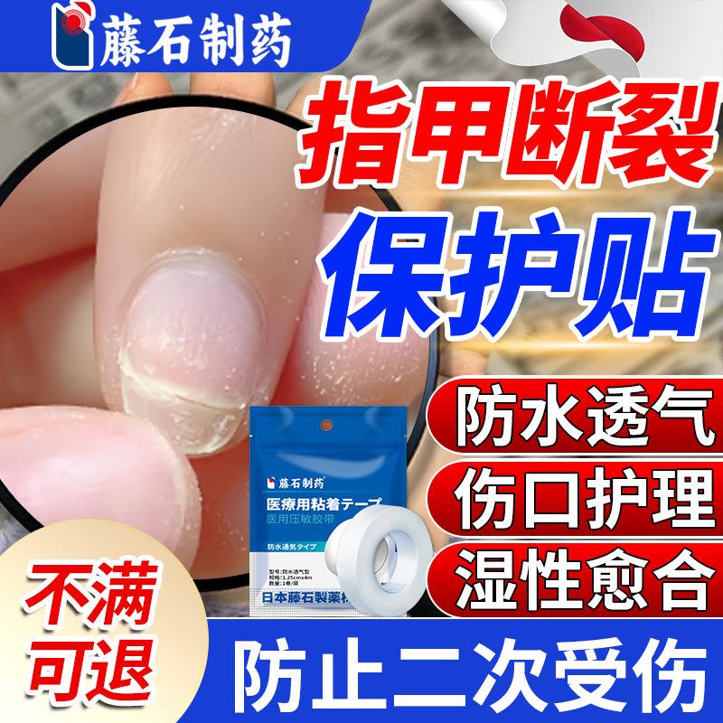 指甲劈了断裂劈裂手指甲盖受伤边缘裂口开裂护甲套保护贴医用级YU,医疗器械,护具（器械）,淘宝优惠券,粉丝福利购,淘宝优惠卷