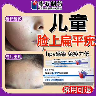 医用孩子脸上扁平疣瘊子肉粒疙瘩面颈部可搭专用祛去除软膏儿童YU