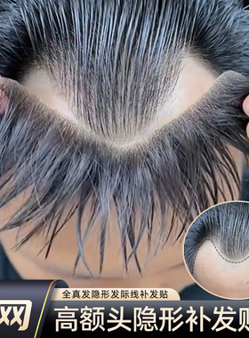 深v形发际线假发贴假刘海假发片m形发际线贴男一片式前额补发真发
