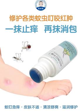 怡贝特叮不痒止痒水植物配方止痒神器消除红包止痛酊官方正品