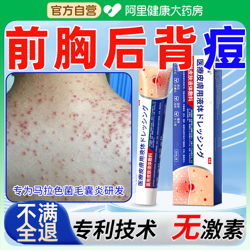 马拉色菌前胸后背背部祛痘身体长痘痘脂溢性毛囊炎除螨虫止痒抑菌