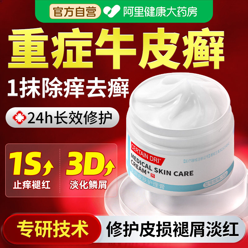 牛皮癣银屑病专用膏治疗皮肤瘙痒真菌感染顽固性皮癣外用止痒抑菌