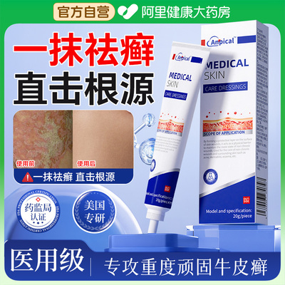 进口牛皮癣病皮肤止痒银屑病特专研真菌感染顽固效用膏官方旗舰店