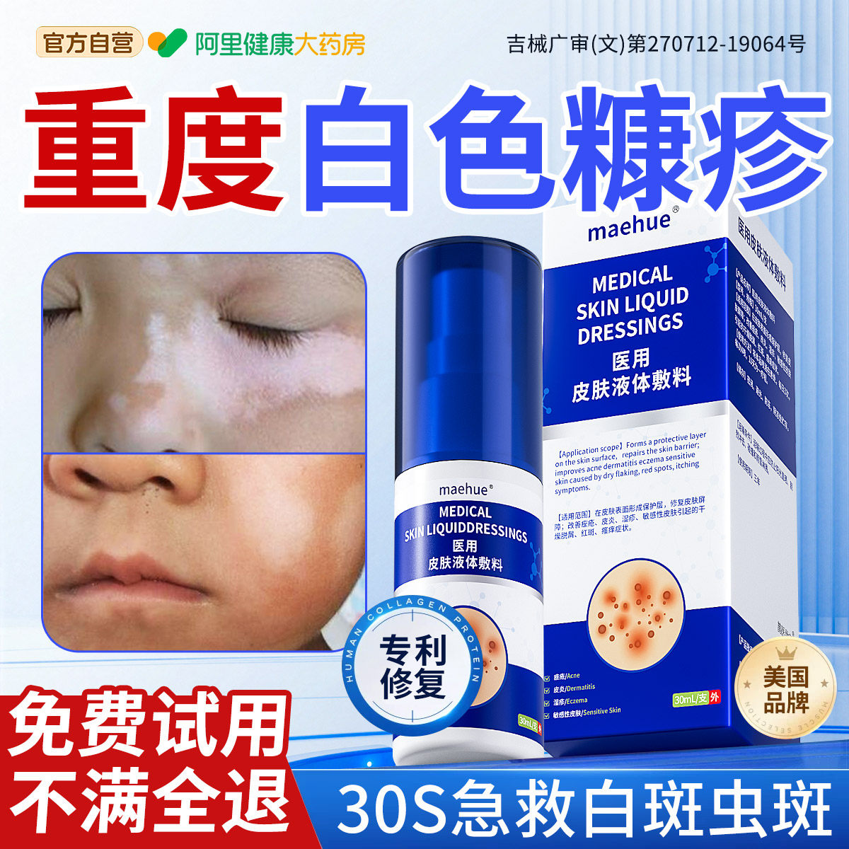 白色糠疹药膏儿童脸上长白斑皮肤干燥止痒脱屑汗斑花斑癣脸部抑菌 - 实物图