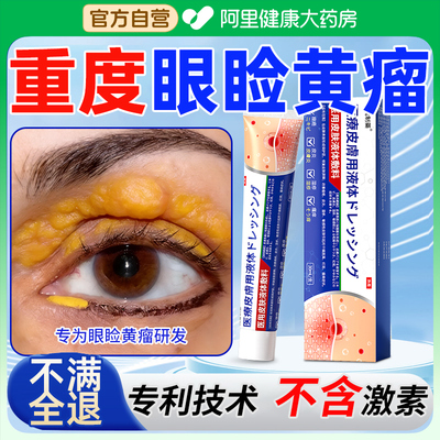 眼睑黄瘤去眼皮黄斑瘤去除药膏神器眼角黄斑瘤眼部眼睑脂肪粒黄斑