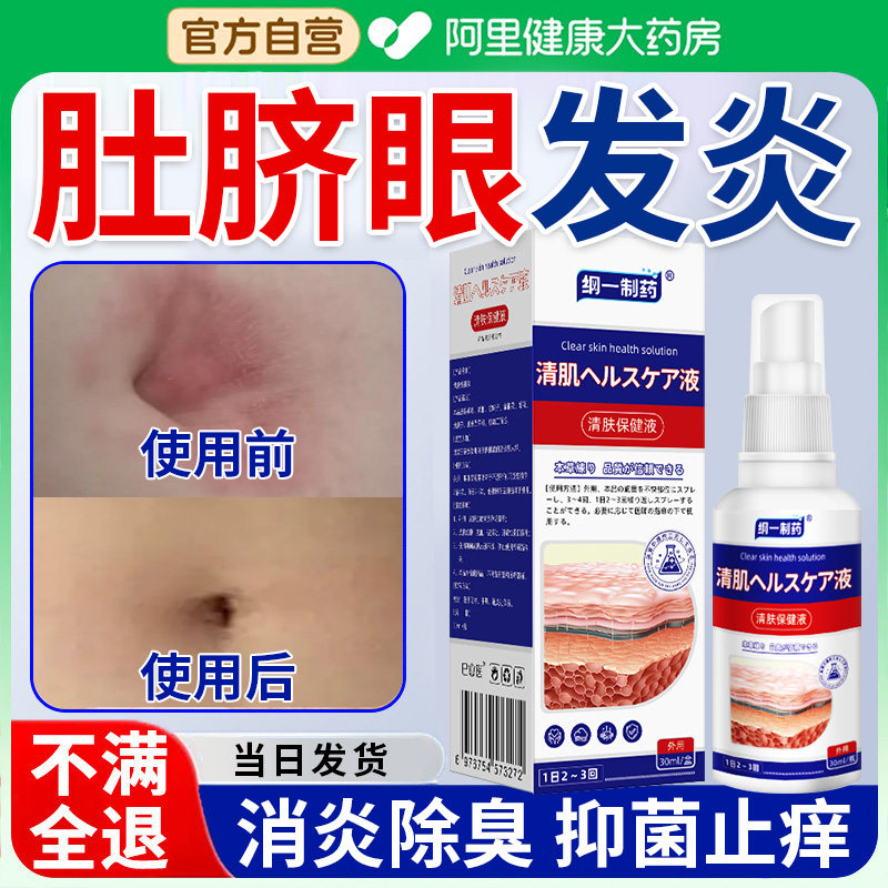 肚脐眼发炎流脓水红肿发炎臭异味瘙痒皮炎清除污垢肚脐眼清洁神器