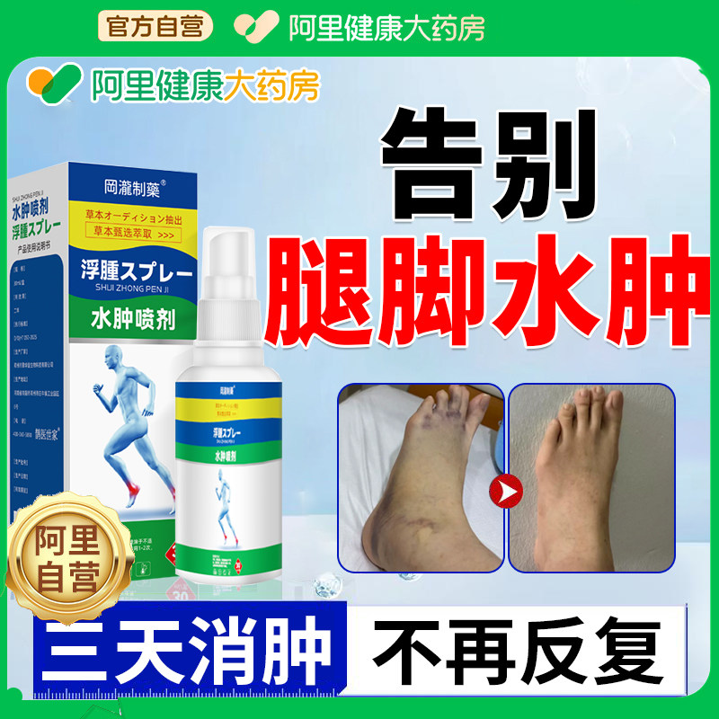 消肿去水肿专用老人脚部非药消肿下肢腿部水肿浮肿利尿消肿去水肿