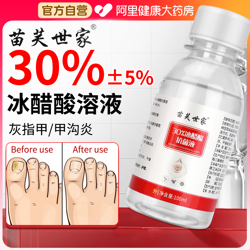 冰醋酸涂剂灰指甲百分之30抗菌溶液高浓度泡脚正品医用官方旗舰店