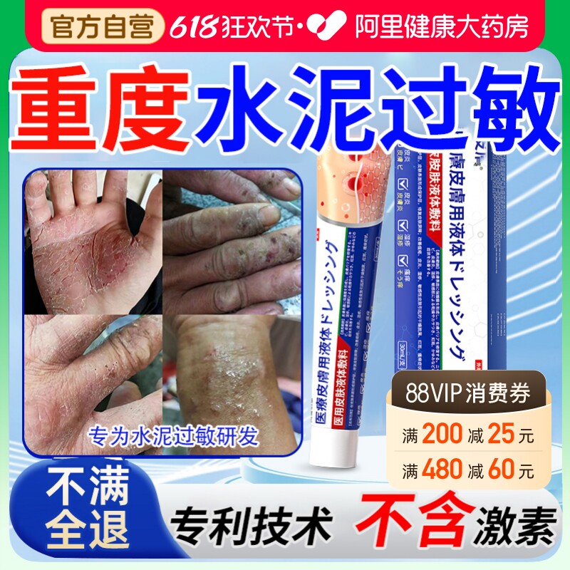 水泥过敏止痒药建筑抑菌蜕皮手痒干裂红肿水泡皮肤长藓外用膏瘙痒