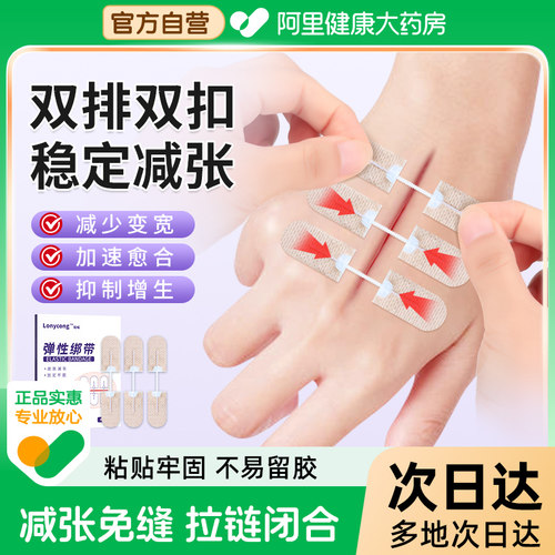 医用减张器剖腹产甲状腺减张贴术后疤痕伤口愈合拉链式免缝合减张