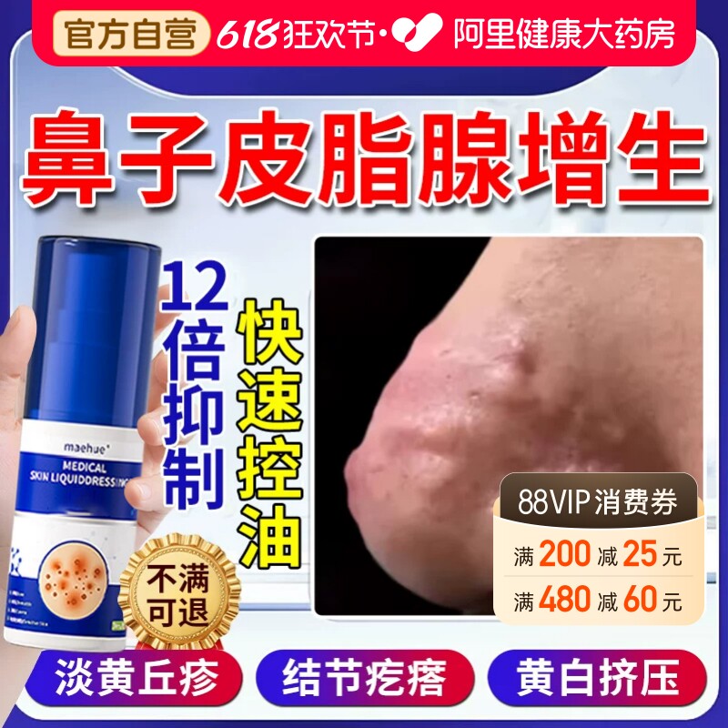 鼻子皮脂腺增生鼻翼长上肉疙瘩鼻赘面部小颗粒除酒糟鼻皮肤修复药