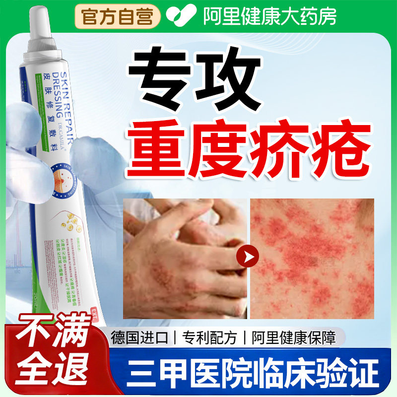 疥疮干疮的专用螨虫疥螨止痒结节皮肤瘙痒湿疹治疗阴囊瘙痒