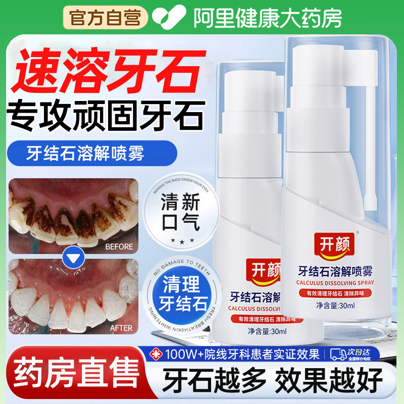 牙结石去除器溶解牙石速效洗牙齿污垢除牙石牙渍去黄口臭清洁神器