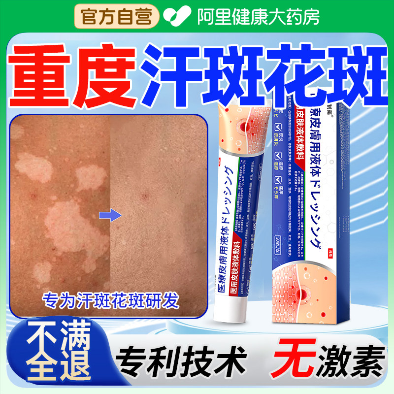 汗斑花斑癣专用治消白斑癣腋下后背净快速乳膏皮肤特真菌感染克星