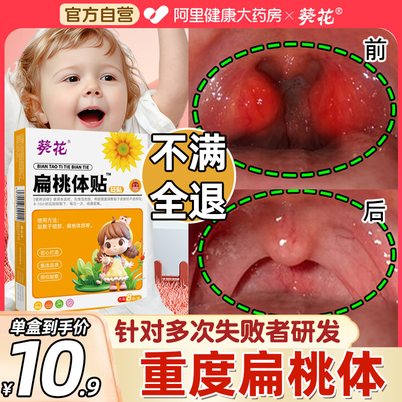 葵花儿童扁桃体腺样体肥大肿大贴中药调理保健治疗发炎腺体呼吸药