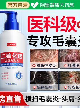 医护二硫化硒毛囊炎洗发水头皮部专用马拉色菌去屑止痒脂溢性皮炎