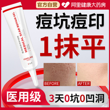 医用型重度痘坑凹洞修复生长因子祛痘印修复淡化痘印去黑色素沉淀