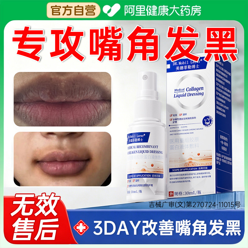 嘴角发黑去除嘴巴周边黑唇周黑改善嘴唇黑色素嘴角暗沉唇膜唇膏抗