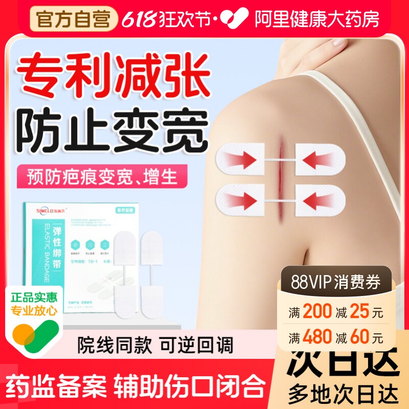 施美乐医用减张器拉链式减张贴伤口手术后疤痕免缝合