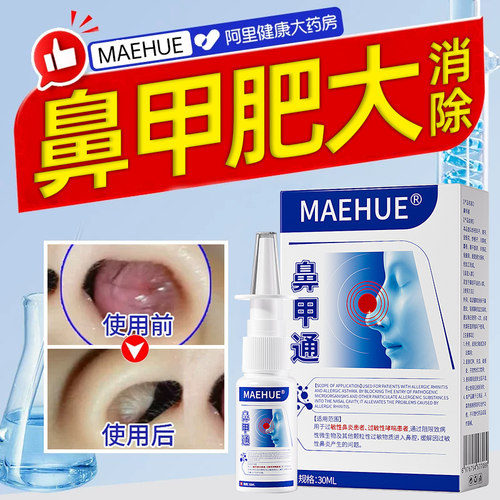 鼻甲肥大专用喷雾剂缓解鼻塞修复神器鼻腔鼻窦鼻息肉脱落流鼻涕